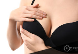 ¿En qué casos es necesaria una segunda cirugía de mama?